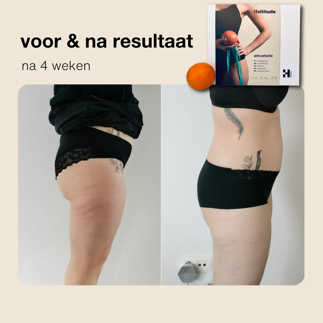anti-cellulite box