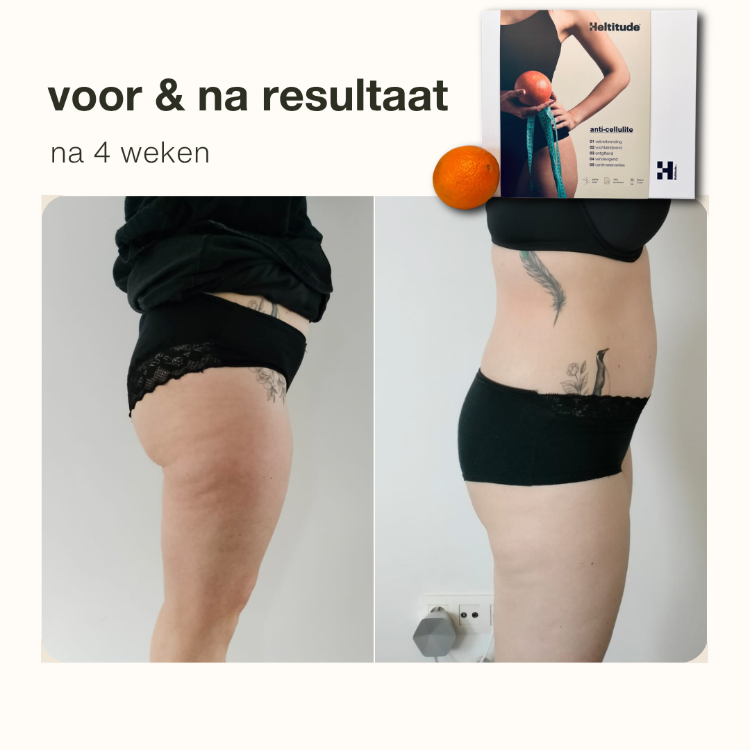 anti-cellulite box